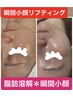 脱ブルドッグ顔！究極小顔二重顎撃退＊理想の輪郭形成
