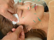 ほぐし堂の雰囲気（【美容鍼☆極】デビュー。美容鍼のフルコンボ３回セット♪）