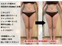 ヨサパーク グランス(YOSA PARK glans)/3回連続で変わるスイッチをON