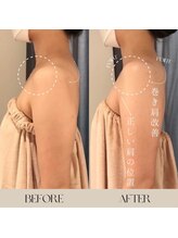 インフィニーズ(INFINEEZ)/カスタマイズ90分巻肩矯正20代