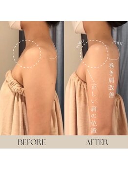 インフィニーズ(INFINEEZ)/カスタマイズ90分巻肩矯正20代