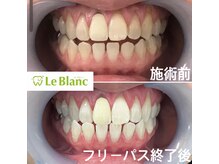 ルブラン 奈良店(Le Blanc)/もうすぐ12月！！