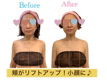 ルフレ(Rufure)/劇的ビフォーアフター♪