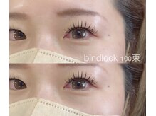 ビュー(V.I.E.W)/BINDLOCK100束