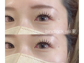 ビュー(V.I.E.W)/BINDLOCK100束