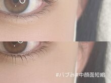 エールバイメアリー(aile by mary)/中顔面短縮【 下まつげパーマ 】