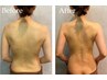 新規【小顔＆背中美人】背中リンパマッサージ＋ハイパーナイフ小顔90分¥10800
