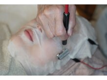 岩川治療院/LACトリートメント