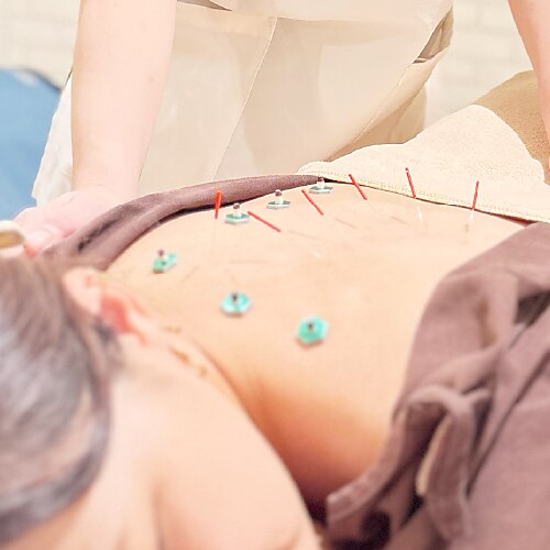 【感謝祭SALE】深いコリ/お悩み◎鍼灸(はり)+整体60分/8090円→3980円