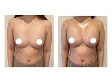 スマイルクルー(SmileClue)/ビフォーアフター症例