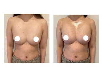 スマイルクルー(SmileClue)/ビフォーアフター症例