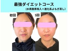 ヨサパーク ルアナ 高島店(YOSA PARK Luana)の雰囲気（水素はダイエット、むくみ、しわ、しみ、体の内側から激変◎）