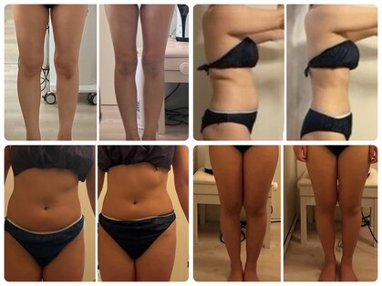 ナースのロミリンパの写真