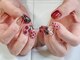Re:terp NAIL 【リタープネイル】の写真/【仕上がり◎】持ち込みデザイン≪シンプル≫8000円/≪ボリューム≫１００００円☆どんなネイルもお任せ♪