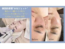  ハリー 神戸三宮店(HARRY)の雰囲気（“希少”ヒト臍帯幹細胞上清液を基底層まで導入◎）