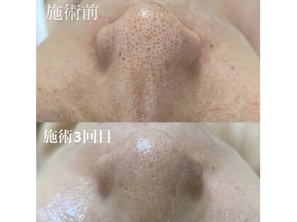ミラージュ(Milarju)の写真