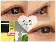 アン(an)/マツパ