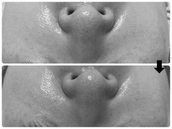 エフェクト 塚口店(effect)/Before After