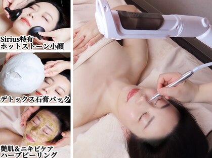 シリウス(Sirius)の写真