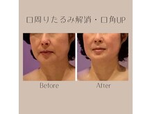 ポテンツァ×エクソソーム