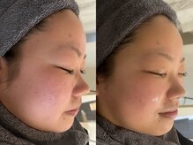 リリー(LILLY)の雰囲気（確実な肌質改善と小顔改善をご提供）