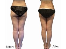 京都フォーエイチ(京都4H)/太もも・ふくらはぎ・足首集中