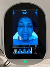 衝撃は予防のチャンス。特殊な光が暴く「隠れジミ」の分布と深刻度を可視化