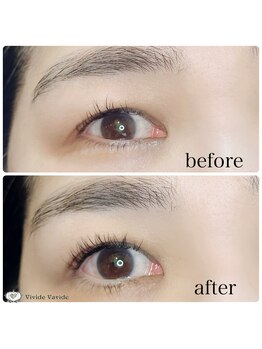 ビビデバビデ(Vivide Vavide)/24時間ぱっちりお目元【銀座】