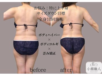 小顔職人/ボディビフォーアフター/50代