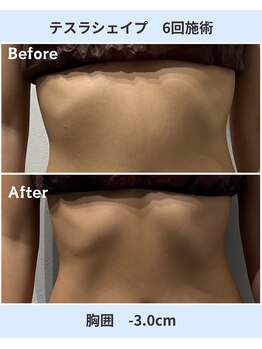 アーヒル 富山店(A”-HILU)/