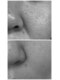彩(irodori)の写真/毛穴特化の彩ハーブピーリングが人気！自信の持てる素肌へ。彩ハーブピーリングをお得に体験♪
