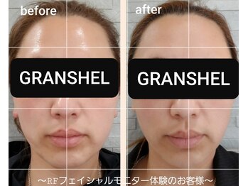 グランシェル(GRANSHEL)/