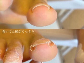 キラネイル アンド アイラッシュ by World Beauty(KIRA)/新潟ペディグラス