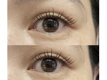 ビュー(V.I.E.W)/FLATLASH付放題