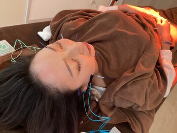 ハリファ鍼灸院 横浜関内院(HariFa鍼灸院)/リフトアップ美容鍼