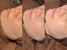 ルーナジェーナ(Luna llena)/池袋　エステ　ルーナジェーナ