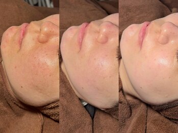 ルーナジェーナ(Luna llena)/池袋　エステ　ルーナジェーナ