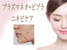 ニキビケアをしたい方に【クレンジング＋プラズマネオ】60分9800円