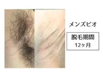 メンズビオ 神戸三宮店/