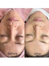 シロ(siro)/韓国水光肌・美白フェイスWax