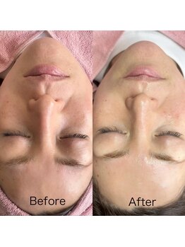 シロ(siro)/韓国水光肌・美白フェイスWax