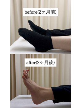 ルーツ 渋谷店(R∞ts)/神経障害にも対応【渋谷/整体】