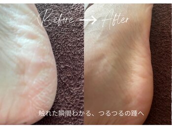 フロレゾン(Floraison)/仕上がりは踵までふっくら♪