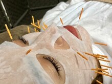 クローバー治療院