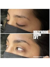 ディアビム(DiAViM)/＊ハリウッドブロウリフト＊