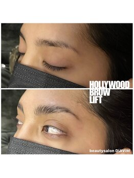 ディアビム(DiAViM)/＊ハリウッドブロウリフト＊