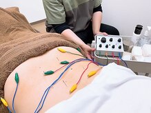 たかさき下小鳥鍼灸 接骨院/鍼灸の施術風景