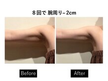 ナチュラーレ 梅田店(Naturale)/リンパマッサージ痩身ダイエット