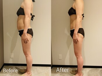 エステティック ミュー(Esthetic MiEUX)/全身痩せコース5回目