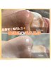 ０距離毛穴レス肌へ♪【ドライヘッドスパ付】韓国式毛穴洗浄（全顔）￥5000